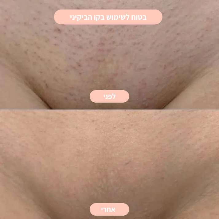 מכונת הגילוח של LUNERE